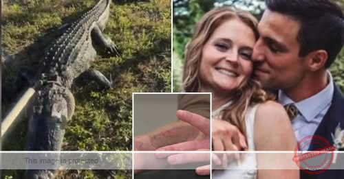 Florida Woman’s Terrifying Encounter with Alligator: A Story of Survival and Resilience