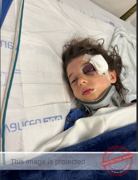 9-Year-Old Sophia Martinez in Critical Condition After Baseball Bat Accident