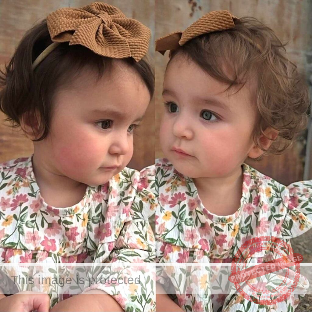 A Viral Baby With Two Sets of Colors Shares a Story of Survival and Science