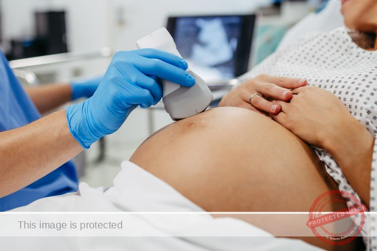 During a Routine Final Ultrasound, One Expectant Mother Faced an Unexpected Moment