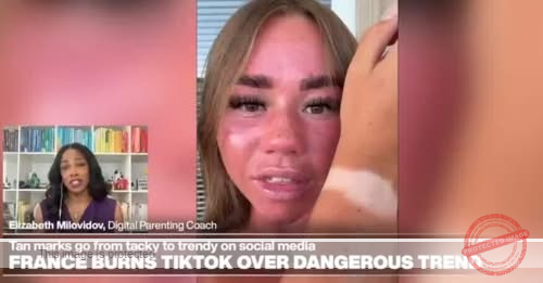 TikTok Trend Promotes Risky Halterneck Tan Lines, Experts Warn of Health Dangers