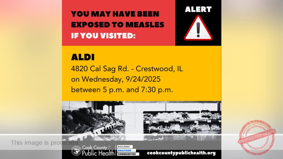 Third measles case detected in Cook County, officials say
