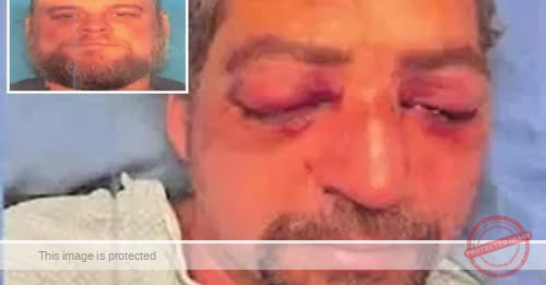 Trucker Brutally Attacked in Road Rage Incident, Leaving Victim With Severe Injuries