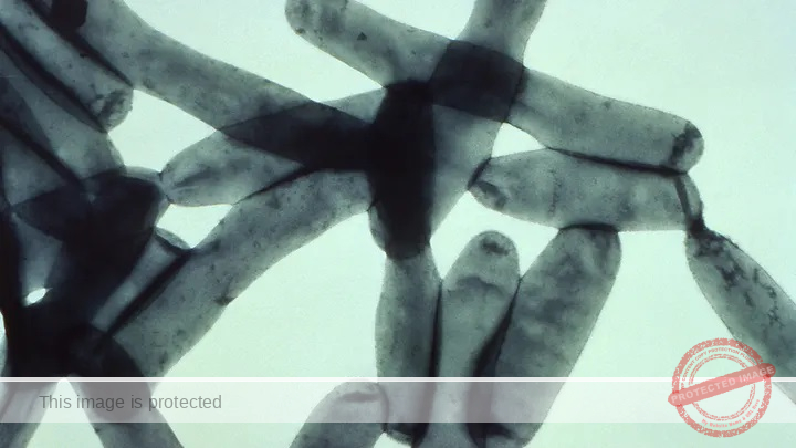 Two cases of Legionnaires’ disease reported in Bloomingdale rehab center: officials